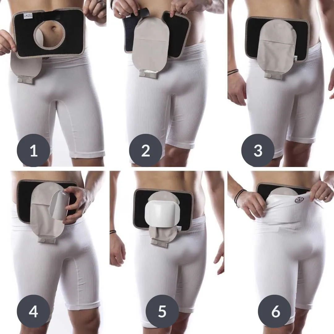 COMFISHIELD SET STOMA PROTECTOR